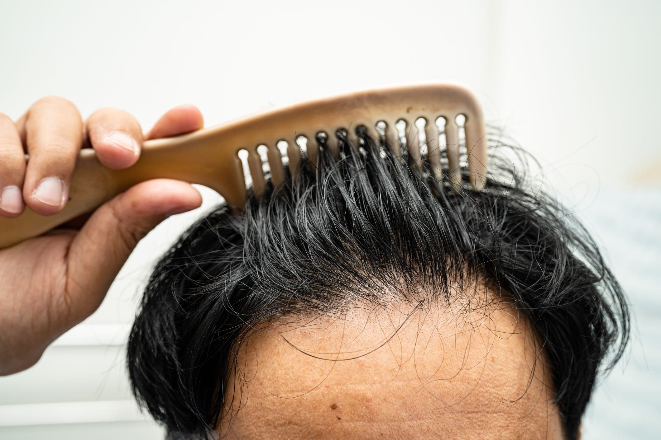 Dinh Dưỡng Tóc Khỏe: 15 Thực Phẩm Giúp Tóc Dày, Chắc Khỏe